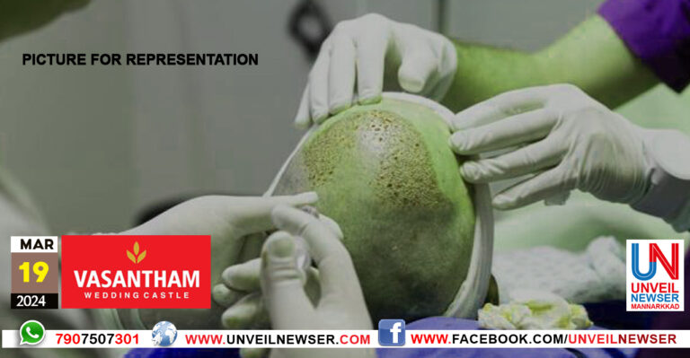 HARI TRANSPLANTATION